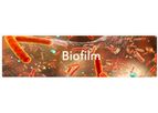 Biofilm Removal