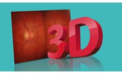Kowa Nonmyd WX-3D Simultaneous Stereoscopic Retinal Camera - Video
