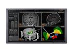 Neuroinspire - Surgical Planning Software