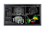 Neuroinspire - Surgical Planning Software