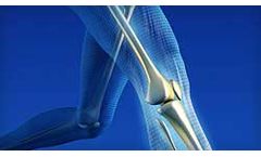 Biomechanical Anaylsis Services