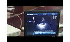 DCU30 Cardiac Testing Video