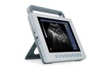 Kaixin - Model K10 - Full Digital B Mode Ultrasound Scanner