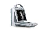 Kaixin - Model ODU5 - Ophthalmic A/B Ultrasound Scanner