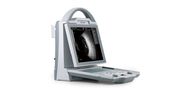 Ophthalmic A/B Ultrasound Scanner