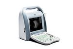 Kaixin - Model ODU8 - Ophthalmic A/B Ultrasound Scanner