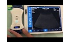 Revolutionary Double head wireless ultrasound probe device operation Video
