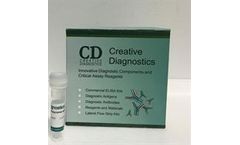 Creative Diagnostics - Model DEIA1810 - Human RF IgM EIA Kit