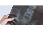 X ray films scrap available