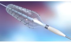 Revolutionising Cardiovascular Health: Monitoring the Surface Metallurgy of Stents