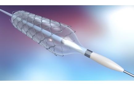 Revolutionising Cardiovascular Health: Monitoring the Surface Metallurgy of Stents