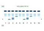 Hellabio - Model PE10 / MPE - Protein Electrophoresis kit