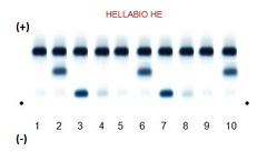 Hellabio - Model HE10 / MHE - Hemoglobin Electrophoresis kit