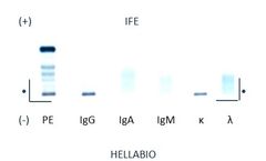 Hellabio - Model IFE01 / IFE D01 / IFEU - Immunofixation electrophoresis