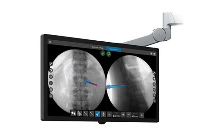 Stryker - Version SpineMap Go - SpineMap Augmented Fluoroscopy Software