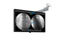 Stryker - Version SpineMap Go - SpineMap Augmented Fluoroscopy Software