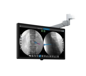 Stryker - Version SpineMap Go - SpineMap Augmented Fluoroscopy Software