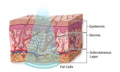 Ultrasound measurement instrumentation solutions for therapeutic sector 	