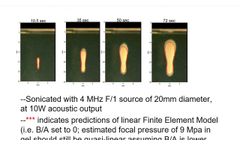 Characterization of a HIFU Fields Inside a Tissue Mimicking Phantom - Video