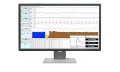 IOX2 - Physiological Data Acquisition & Analysis Software