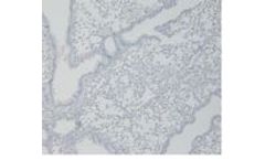 Abcam - Model ab269452 - Mouse on Mouse Polymer IHC Kit
