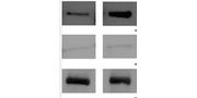 Plasma Membrane Protein Extraction Kit