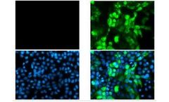 GeneTex - Model SARS-CoV-2 (COVID-19)-[HL5511] - Nucleocapsid Antibody