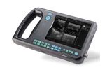 Shinova - Model SonoScan A1V - Palm Ultrasound System