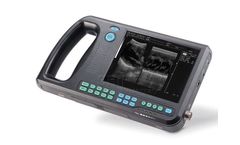 Shinova - Model SonoScan A1V - Palm Ultrasound System