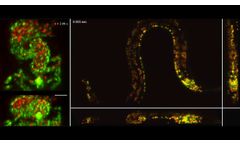 SCAPE 2.0 dual-color 3D imaging of zebrafish embryo and C. elegans.- Video