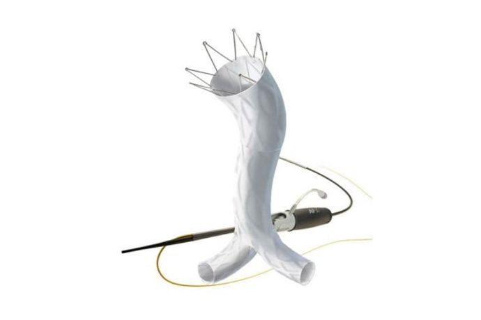 Endologix AFX - Endovascular Abdominal Aortic Aneurysm (AAA) System