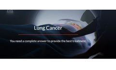 Diagnostic Solutions for Lung Cancer