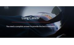 Diagnostic Solutions for Lung Cancer