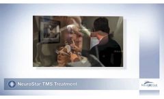 52 60211 104 OUS Animation TMS therapy - Video