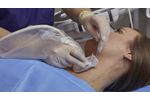 Envision Ultrasound Probe Covers & Scanning Pads from CIVCO - Video