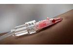 TrueSafe Comfort - Model BC - Blood Control IV Catheter