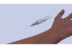 MedSource Labs ClearSafe Safety IV Catheter Training Video