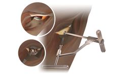 Anterior Path - Tissue Sparing Surgical Hip Approaches