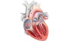 JenaValve - Human Heart Anatomy Pump