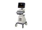 Shimai - Model S60 - Standard Trolley Color Ultrasound Machine with Three Probes