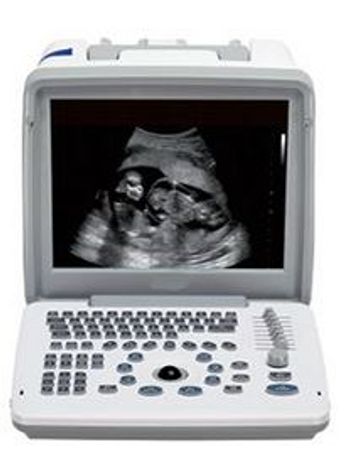 Shimai - Model M30 - Portable Black and White Ultrasound Equipment with Two Probes