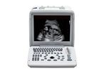 Shimai - Model M30 - Portable Black and White Ultrasound Equipment with Two Probes