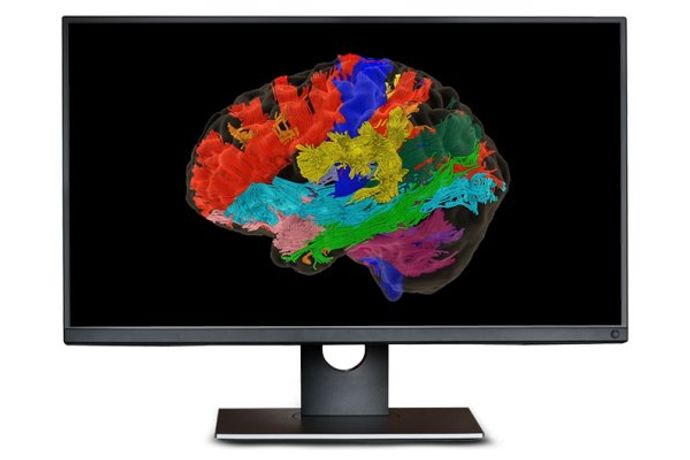 Synaptive ModusPlan - Patient-Specific Tractography System