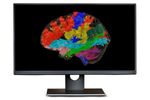 Synaptive ModusPlan - Patient-Specific Tractography System