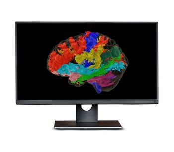 Synaptive ModusPlan - Patient-Specific Tractography System