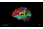 Modus Plan provides easy access to tractography - Video