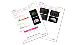 Hepatica - Clinical and Surgical Decision Support Tool