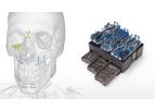 OsteoMed - Model CFx - Craniomaxillofacial Fixation System
