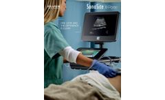 Sonosite - Model X-Porte - Ultrasound Imaging System - Brochure