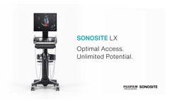SONOSITE LX: Optimal Access. Unlimited Potential- Video